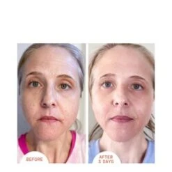 Dr Dennis Gross Alpha Beta Peel Extra Strength -Elemispayot Shop Alpha Beta Peel Extra Strength add2 26579 3958 general