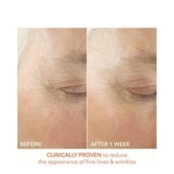 Dr Dennis Gross Alpha Beta Ultra Gentle Daily Peel 6 Dr Dennis Gross Alpha Beta Ultra Gentle Daily Peel -Elemispayot Shop Alpha Beta Ultra Gentle Daily Peel add2 65347 812 general