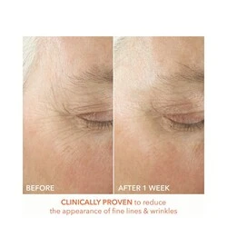 Dr Dennis Gross Alpha Beta Ultra Gentle Daily Peel 3 Dr Dennis Gross Alpha Beta Ultra Gentle Daily Peel - Image 3