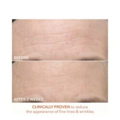 Dr Dennis Gross Alpha Beta Ultra Gentle Daily Peel 7 Dr Dennis Gross Alpha Beta Ultra Gentle Daily Peel -Elemispayot Shop Alpha Beta Ultra Gentle Daily Peel add3 65347 7832 general