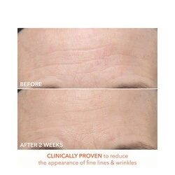 Dr Dennis Gross Alpha Beta Ultra Gentle Daily Peel 4 Dr Dennis Gross Alpha Beta Ultra Gentle Daily Peel - Image 4