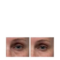 Dr Dennis Gross Hyaluronic Marine Dew It Right Eye Gel 5 Dr Dennis Gross Hyaluronic Marine Dew It Right Eye Gel -Elemispayot Shop Hyaluronic Marine Dew It Right Eye Gel a 50553 6811 general